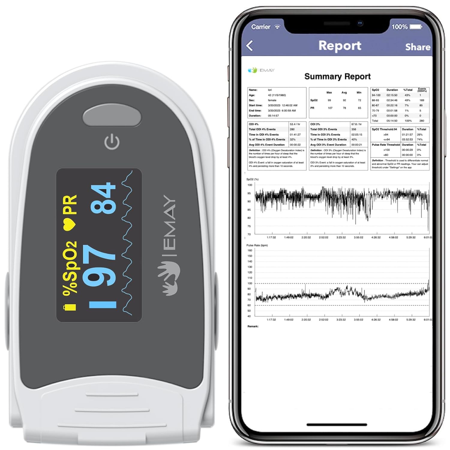 EMAY Sleep Oxygen Monitor Review